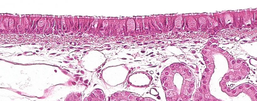 Figura 1: Epitelio ciliato pseudostratificato con cellule caliciformi caratteristico dell&#39;apparato respiratorio.
