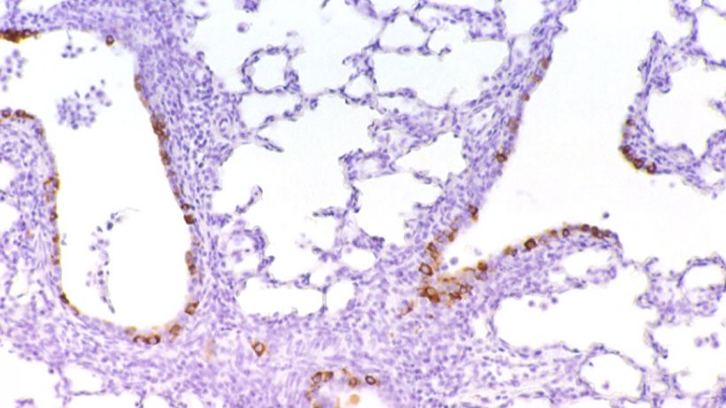 Figura 6: Cellule immuno-marcate contro il PRCV nell&#39;epitelio bronchiolare.
