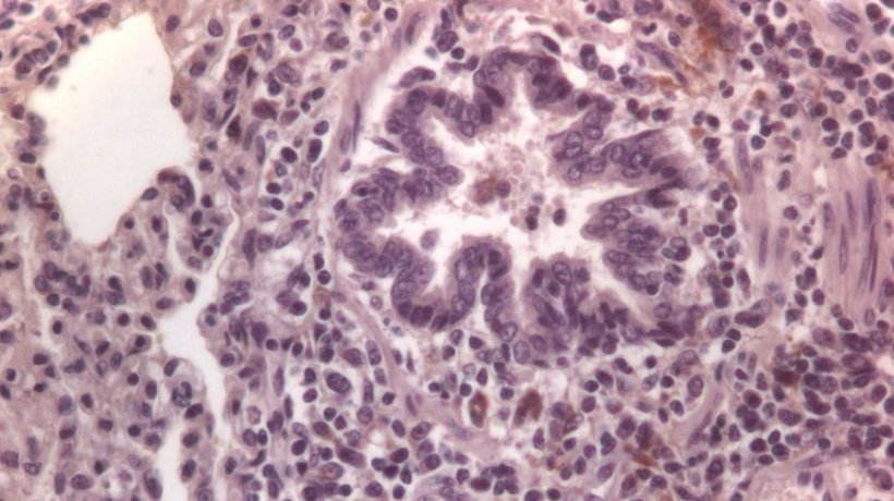 Figura 3: Cellule immuno-marcate contro il PCV2 nei polmoni.
