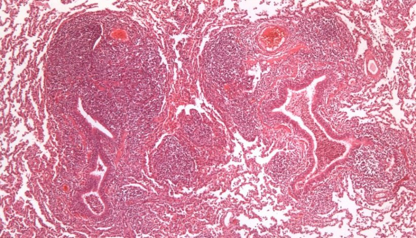 Figura 2: Iperplasia del tessuto linfoide peribronchiolare causata da M. hyopneumoniae.
