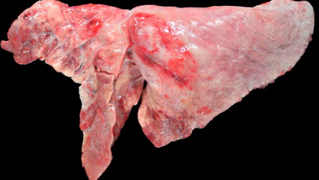 Figura 5: Pulmón de un cerdo coinfectado con M. hyopneumoniae y A. pleuropneumoniae. Aree di consolidamento cranio-ventrale di color bruno-rossastre, provocate dalla infezione da M. hyopneumoniae, e una lesione ovale con fibrosi pleurica e zone emorragiche nel lobo diaframmatico,  che corrisponderebbe alla cronicità di un focolaio di necrosi prodotto da A. pleuropneumoniae.
