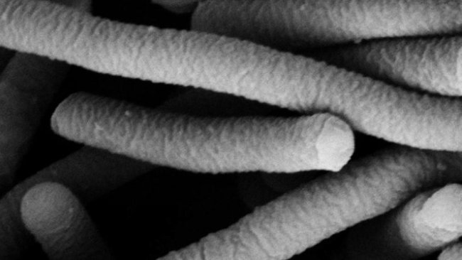 Foto 1. Micrografia elettronica di Lactobacillus acidophilus, che ha caratteristiche probiotiche. Foto di Mogana Das Murtey e Patchamuthu Ramasamy.