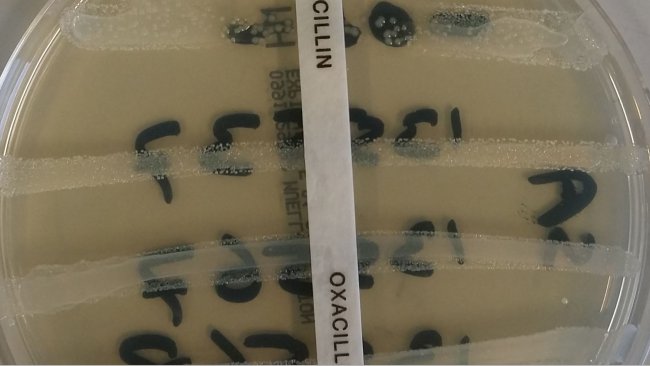 Resistenza antimicrobici
