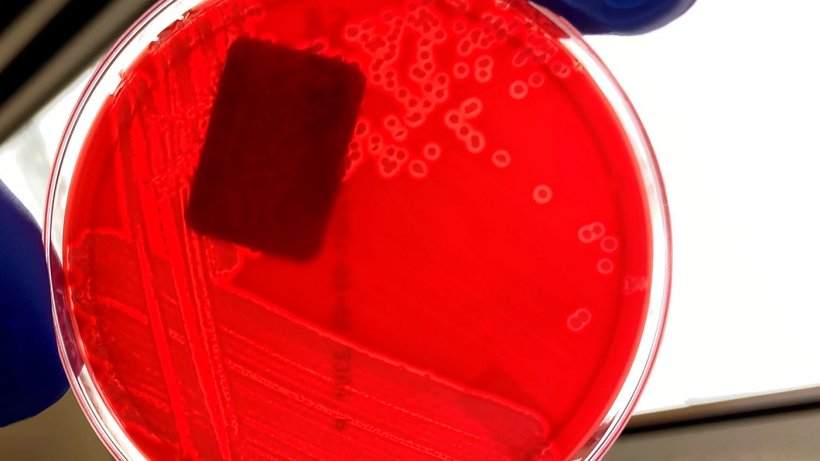 Figura 1. Coltura pura di E. coli emolitico su agar sangue. L&#39;area chiara intorno a ciascuna colonia batterica indica l&#39;emolisi (ripartizione del sangue sulla piastra di agar). Fonte: Iowa State University, Laboratorio di Diagnostica Veterinaria, Sezione di Batteriologia.
