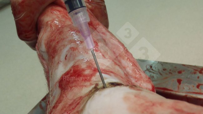 Figura 1. Raccolta del campione di liquido articolare da un suino morto. La pelle viene rimossa e viene utilizzata una siringa per raccogliere il liquido articolare in modo asettico.