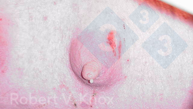 Calostro goteando de la glándula mamaria