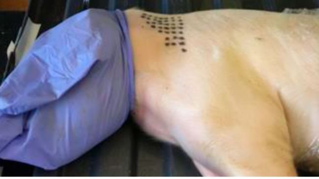 Misurazione della forza di iniezione dell'ago