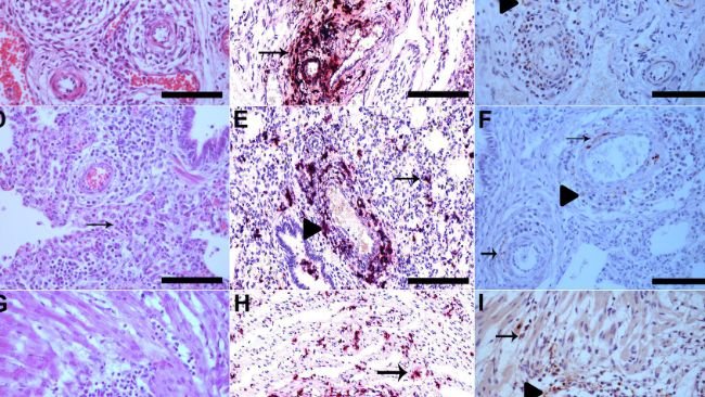 Figura 1. (A) Le pareti dei vasi del plesso mesenterico sono interrotte da una marcata infiltrazione di linfociti, istiociti e plasmacellule, oltre alla degenerazione fibrinoide (freccia), HE, Bar. 120 μm. (B) Plesso mesenterico vascolare con colorazione PCV3 nelle cellule infiammatorie e nelle pareti dei vasi che è mostrato in rosso (freccia), l'ematossilina è stata utilizzata come colorante di contrasto per tingere la sezione tissutale per ISH Bar. 120 μm. (C) Plesso mesenterico vascolare con immunomarcatura PCV3 nel citoplasma delle cellule infiammatorie nelle aree perivascolari (punta di freccia) e nel citoplasma e nel nucleo delle cellule della muscolatura liscia delle arterie (freccia), IHQ, AEC, Bar. 120 μm. (D) Polmone con setti alveolari diffusamente dilatati da linfociti e macrofagi (polmonite interstiziale) (freccia), HE, Bar. 120 μm. (E) Polmone con colorazione multifocale di PCV3 nelle cellule infiammatorie nelle aree interstiziali (freccia) e nelle aree perivascolari, che è mostrato in rosso (punta di freccia), ISH, Bar. 120 μm. (F) Polmone con immunomarcatura PCV3 nel citoplasma delle cellule infiammatorie nelle aree perivascolari (punta di freccia) e nel citoplasma e nel nucleo delle cellule della muscolatura liscia delle arterie (freccia), IHQ, AEC, Bar. 120 μm. (G) area di lieve miocardite linfoistiocitica (freccia), HE, Bar. 120 μm. (H) Cardiomiociti con colorazione PCV3 multifocale, mostrata in rosso (freccia), ISH, Bar. 120 μm. (I) Cuore con immunomarcatura PCV3 nel citoplasma delle cellule infiammatorie (punta di freccia) e nel citoplasma dei cardiomiociti (freccia), IHQ, AEC, Bar. 120 μm.
Ulteriori informazioni su questo testo di originePer avere ulteriori informazioni sulla traduzione è necessario il testo di origine
Invia commenti
Riquadri laterali