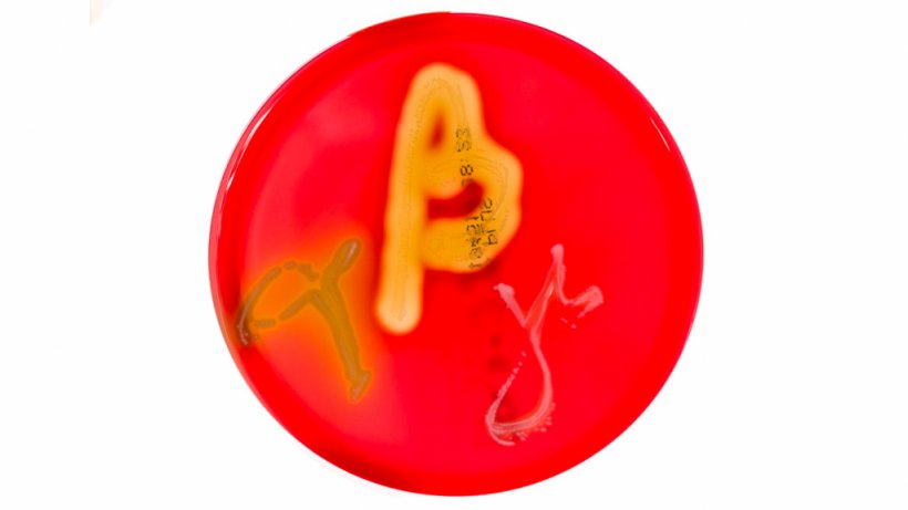 Figura 1. Colture su&nbsp;piastre Petri con&nbsp;agar sangue che mostrano emolisi alfa, beta e gamma. Fonte:&nbsp;Mibilehr https://creativecommons.org/licenses/by-sa/4.0/deed.ene&nbsp;
