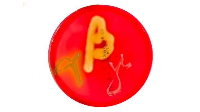 Figura 1. Colture su piastre Petri con agar sangue che mostrano emolisi alfa, beta e gamma. Fonte: Mibilehr https://creativecommons.org/licenses/by-sa/4.0/deed.ene 