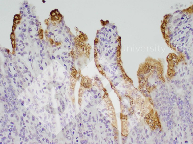 Figura 1. Colorazione IHC della PED&nbsp;nell&#39;intestino tenue infetto. Fonte: Iowa State University VDL
