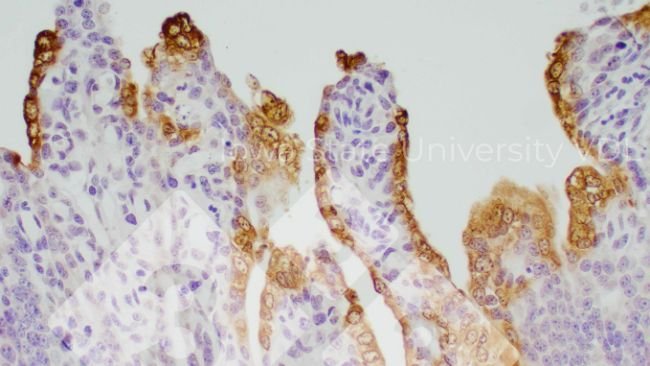 Figura 1. Colorazione IHC della PED nell'intestino tenue infetto. Fonte: Iowa State University VDL