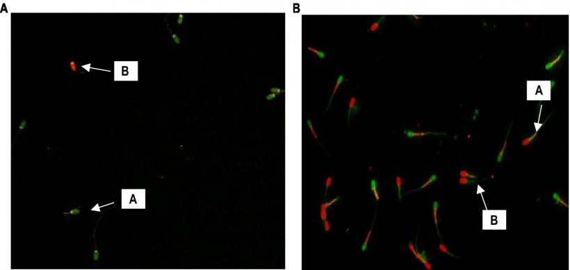 Figura 1. (A) Gli spermatozoi con la freccia “A” che emettono fluorescenza verde hanno DNA intatto, mentre quelli con fluorescenza da arancione a rossa sono spermatozoi con DNA danneggiato (400X). (B) Gli spermatozoi con la freccia "A" che emettono fluorescenza rossa nella regione centrale indicano MMP elevati, mentre quelli con fluorescenza verde sono spermatozoi con MMP bassi (400X).