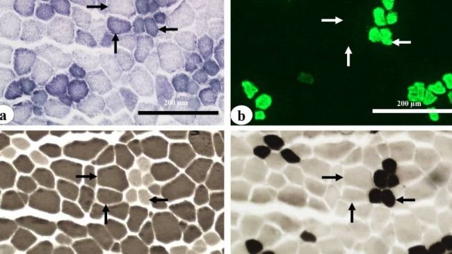IG. 2 Istochimica e immunoistochimica delle fibre muscolari tipizzate in sezioni seriali muscolari di longissimus thoracis di suino.
(a) Colorazione con nicotinammide adenina dinucleotide deidrogenasi-tetrazolio reduttasi (NADH-TR); (b) immunoistochimica con anticorpo primario S58 e anticorpo secondario Alexa fluor488 per la catena pesante della miosina di tipo I; (c) colorazione miofibrillare dell'adenosina trifosfatasi (mATPasi) dopo pre-incubazione alcalina (pH 10,5) e (d) dopo pre-incubazione acida (pH 4,3). Sono stati identificati tre tipi di fibre muscolari: glicolitica a contrazione rapida (IIB), glicolitica ossidativa a contrazione rapida (IIA) e ossidativa a contrazione lenta (tipo I) indicate rispettivamente dalla freccia destra, freccia su e freccia sinistra. Barre=200 μm. NADH-TR, nicotinammide adenina dinucleotide deidrogenasi-tetrazolio reduttasi.