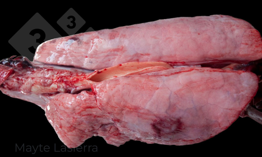 Pleuriti dorso-caudali