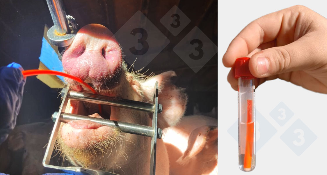 Raccolta di campioni di raschiamento tracheobronchiale