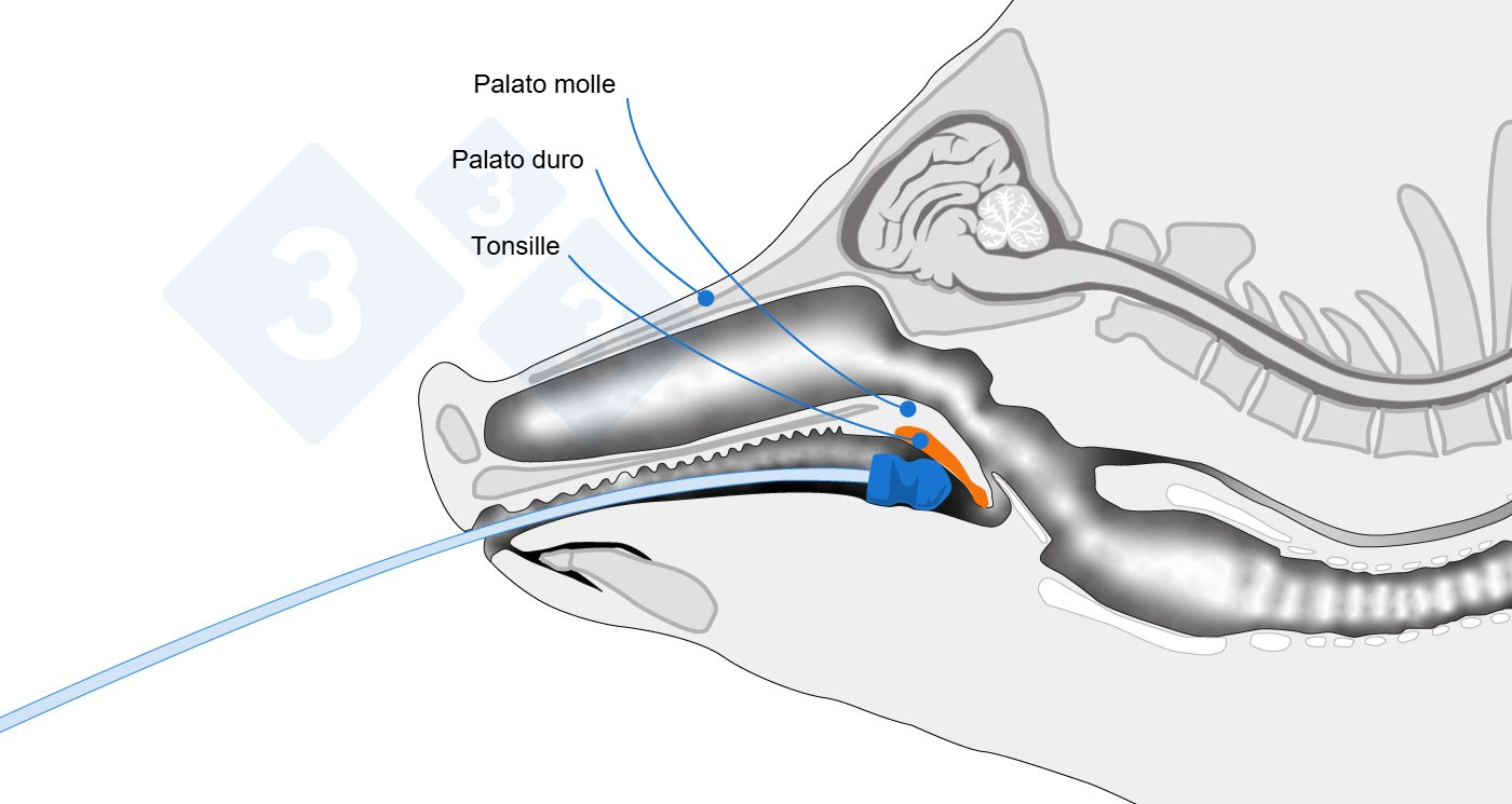 Schema anatomico che indica il punto di campionamento