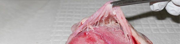 Heart, pericarditis observed with M. hyorhinis systemic disease