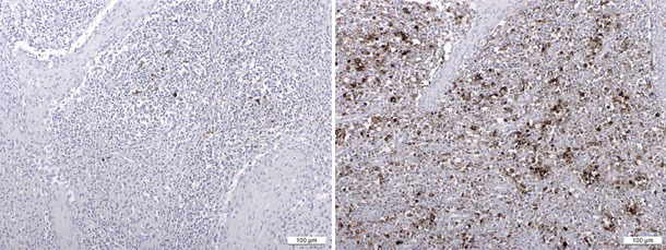 Antigeni PCV2 rilevati dall'immunoistochimica1