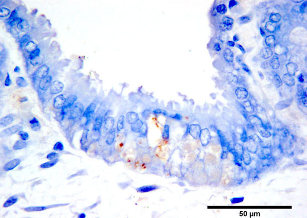 Colorazione marrone per immunoistochimica dell'antigene PCV2b in trofoblasti