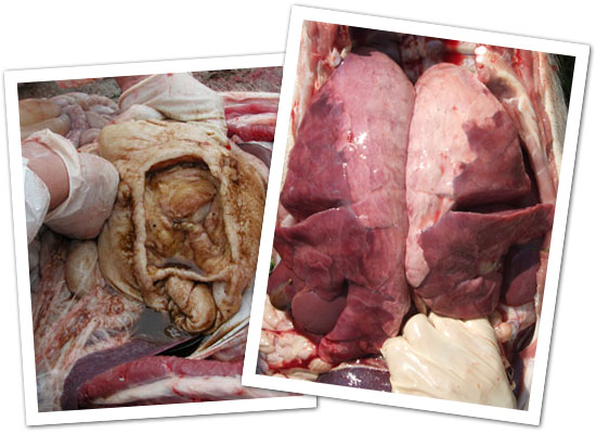 Polmonite e ulcere gastriche
