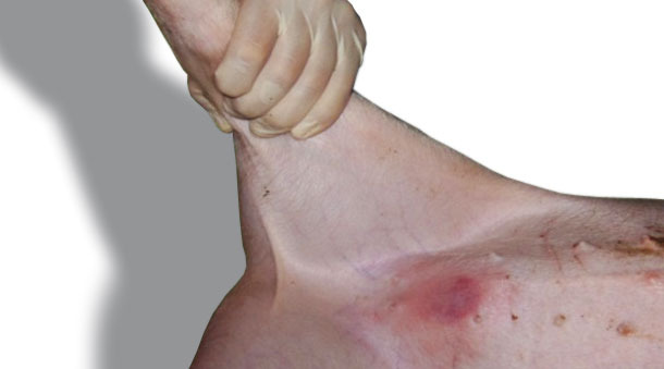 Reazione tipica con eritema osservata 24 ore dopo l'applicazione nella pele dell'addome