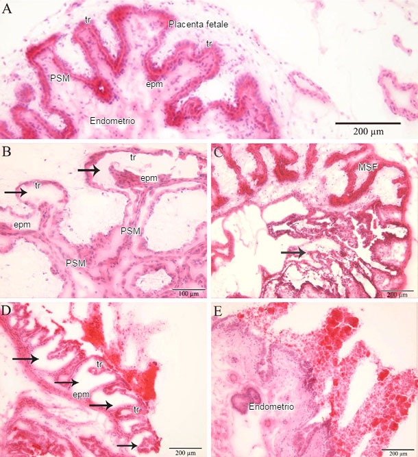 Istopatologia di endometrio e placenta