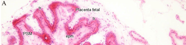 Istopatologia di endometrio e placenta