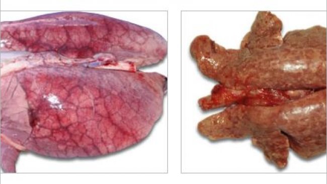 Pulmones