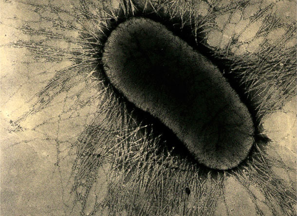 I fattori di adesione di ETEC sono proteine specializzate delle fimbrie o pili, che aderiscono saldamente ai recettori di glicoproteina delle cellule intestinali