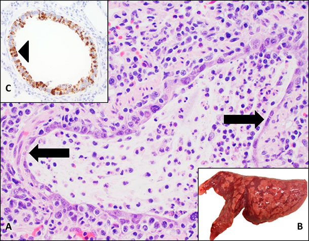 Campioni raccolti per l'analisi dell'influenza