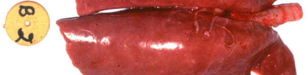 Lesión macroscópica de pulmón