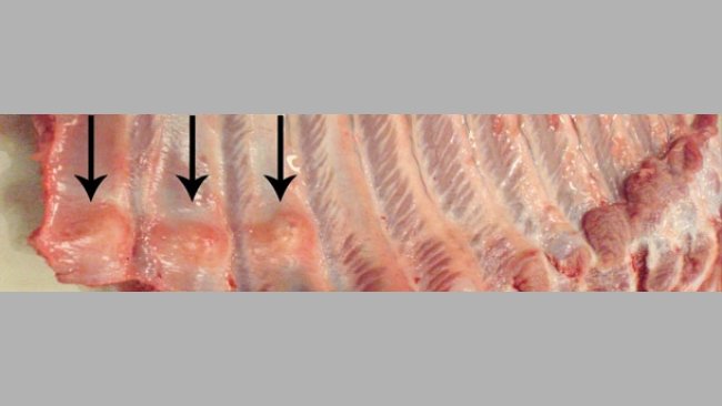 Fratture multiple distali delle costole (freccie)