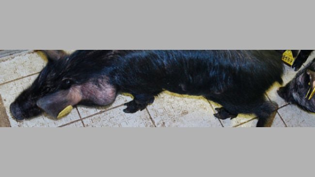 Melanoma e  metastasi nei linfonodi