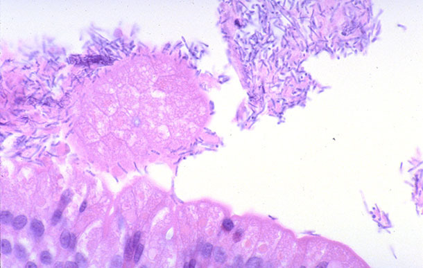 Intestino delgado de un lechón con diarrea asociado a infección por Clostridium perfringens tipo A