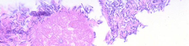 Intestino delgado de un lechón con diarrea asociado a infección por Clostridium perfringens tipo A