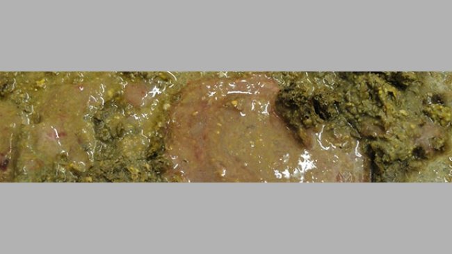 Diarrea con sangre y moco de un cerdo infectado con Brachyspira hyodysenteriae