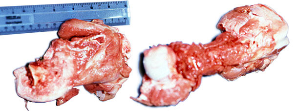 Cabeza del fémur fracturada en uno de los cerdos afectados (izquierda) y fémur normal (derecha).
