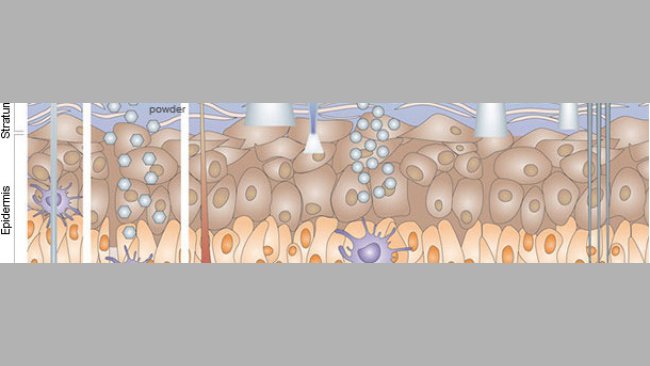 Immunizzazione per via cutanea