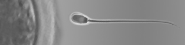 Nueva sección sobre reproducció porcina 1