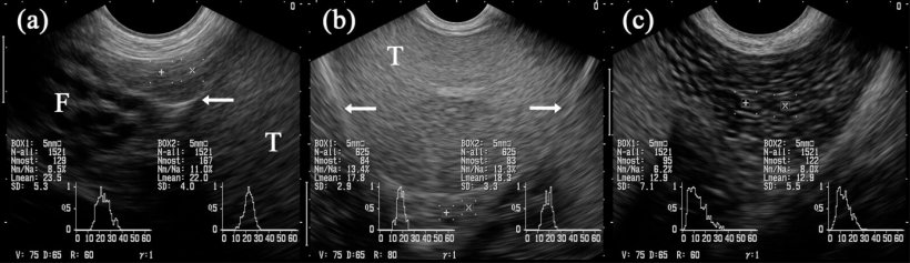 Figura 5:&nbsp;Immagini ecografiche dei segmenti dell&#39;epididimo&nbsp;(= testa, a), corpo&nbsp;(b) e coda&nbsp;(= cola; c). I segnali marcati&nbsp;con &quot;+&quot; y &quot;x&quot; si proiettano nei rispettivi segmenti dell&#39;epididimo. Testicolo&nbsp;(T). &nbsp;Assieme alla testa ci sono strutture tubolari multiple identificate come parte del funicolo spermatico&nbsp;(F). Le frecce indicano la tunica testicolare sierosa&nbsp;(borsa testicolare). (Kauffold et al., 2011)
