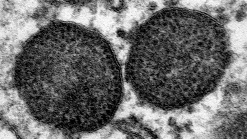 Microfotografia elettronica di due corpi di inclusione nel citoplasma di un macrofago, che include un molto elevato numero di particelle di PCV2. 150.000x. Fonte: Carolina Rodr&iacute;guez-Cari&ntilde;o, CReSA
