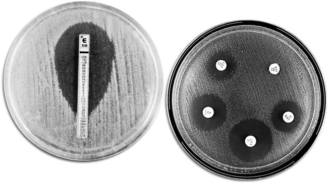 Tecniche classiche di valutazione della resistenza agli antibiotici. A sinistra viene mostrato un E-TEST che permette di misurare la concentrazione minima di antibiotico che impedisce la crescita batterica. A destra viene mostrato un antibiogramma nel quale si osservano diversi aloni di inibizione di crescita da parte degli antibiotici.