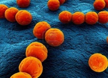 Streptococcus suis