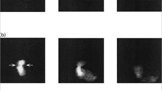 Figura 1. Immagini di svuotamento gastrico nei suini alimentati con una dieta a base di amido (a), polpa di barbabietola (b) e crusca di frumento a 10, 60 e 120 minuti dopo l'ingestione (Fonte: Guerin et al., 2001 ).