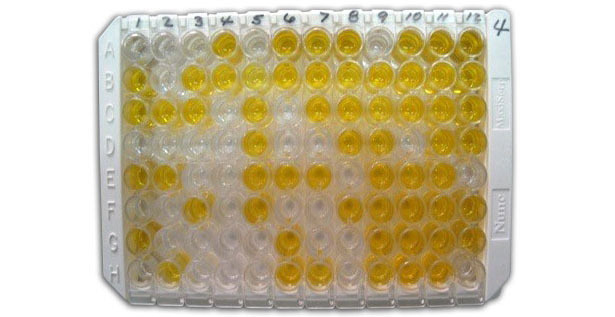Figura 1: ELISA indiretto per rilevare gli anticorpi anti-clamidia nel siero
