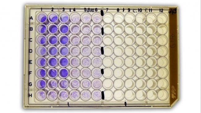 Figura 2b: Sieroneutralizzazione (SN) per la rilevazione degli anticorpi vs il virus della diarrea virale bovina (BVDv) nel siero.