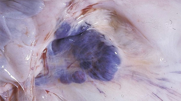 Fotografia 6. Risultati della necroscopia nei suini colpiti. Notare le emorragie dei gangli linfatici mesenterici
