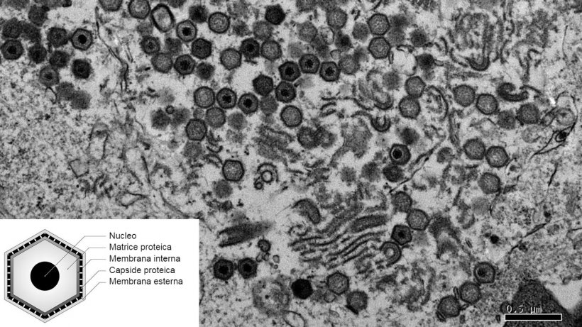 Microscopia elettronica di una cellula infetta con il virus della PSA.
