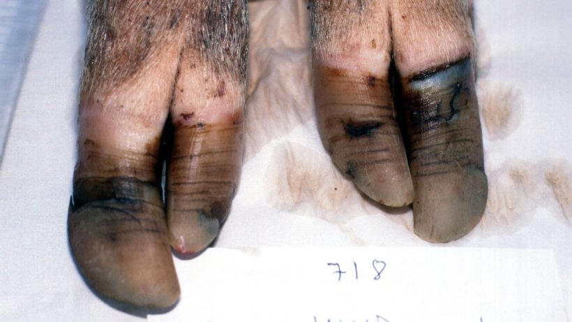 Figura 6. Arti posteriori di una scrofa di 2&deg; parto alloggiata all&#39;aria aperta con una crescita eccessiva e ineguale degli unghielli con divisioni orizzontali.
